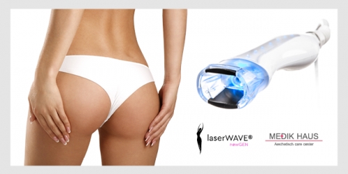 Novinka: Laser Wave, budoucnost laserové liposukce