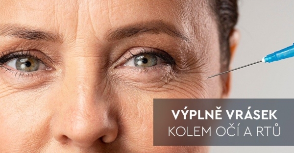 NOVINKA! Odstranění jemných vrásek kolem očí a úst pomocí unikátní výplně  s kyselinou hyaluronovou speciální pro toto okolí. Zpomalte stárnutí pokožky a získejte zpět svěží a mladistvý look s okamžitým efektem.