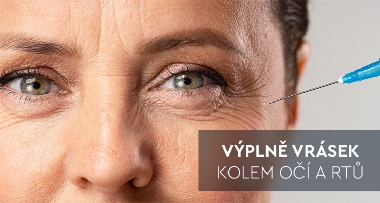 NOVINKA! Odstranění jemných vrásek kolem očí a úst pomocí unikátní výplně  s kyselinou hyaluronovou speciální pro toto okolí. Zpomalte stárnutí pokožky a získejte zpět svěží a mladistvý look s okamžitým efektem.